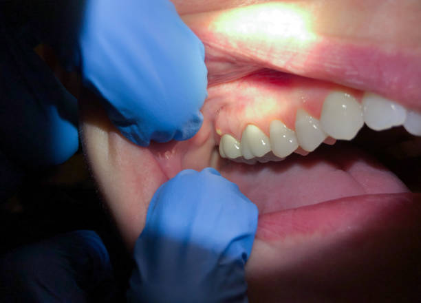 Best Pediatric Emergency Dentist in Carroll, IA